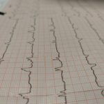 electrocardiogram Review for Inpatient Denial