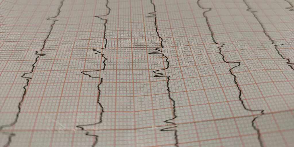 CS-chest-pain-non-cardiac