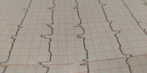 CS-chest-pain-non-cardiac denial overturned