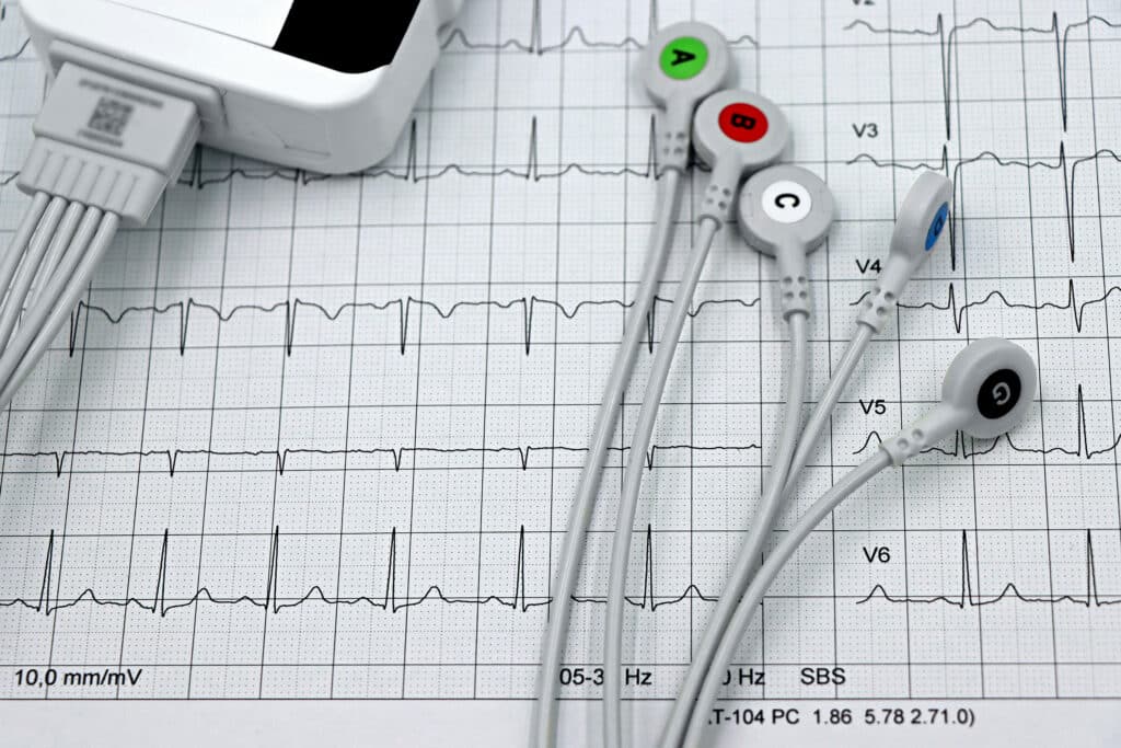 AppriseMD’s latest case study centers on a patient that was hospitalized for chest pain, and the claim was denied based on unproven medical necessity and a lack of reasonable expectation of hospitalization that crossed two midnights.