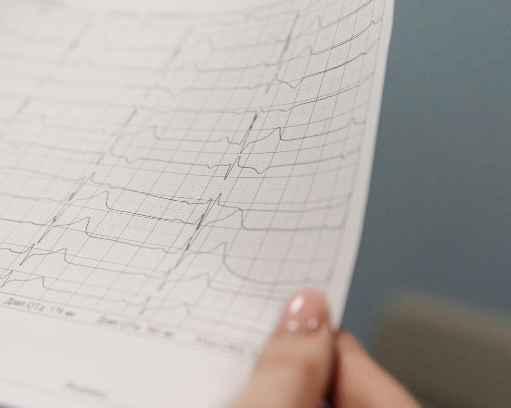 EKG in pediatric short stay case