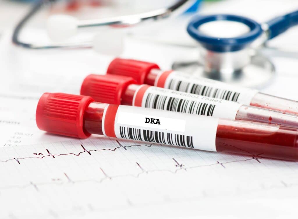 Blood work for DKA testing