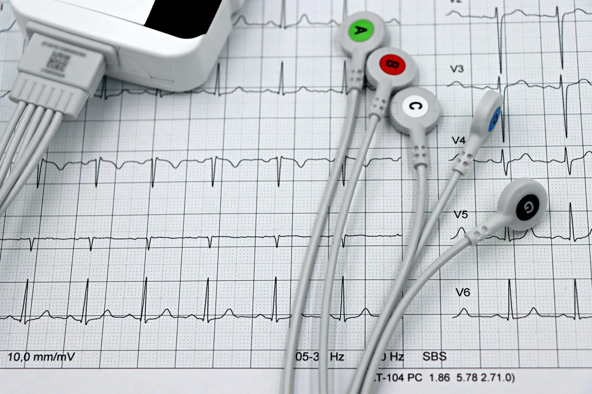 AppriseMD Case Study: Complex Medical History, ICD & Transfer Impact Inpatient Denial Reversal