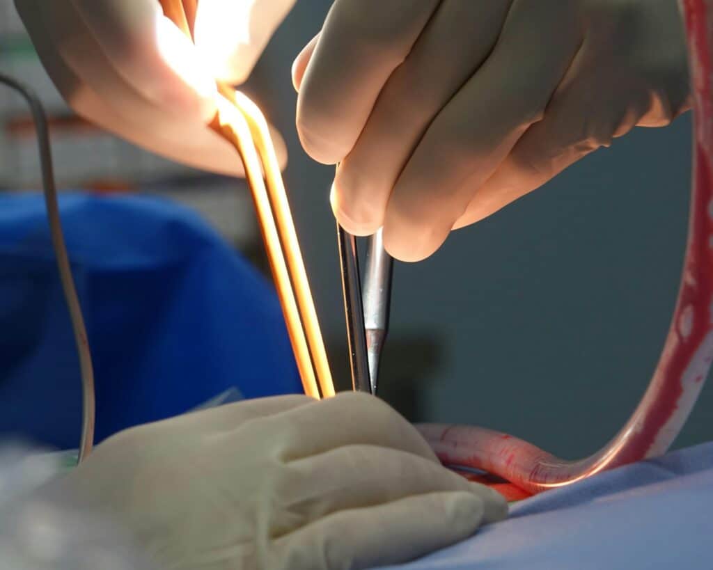 Case study reviews level of care severity